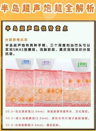 半島黃金超聲炮和超聲炮的區(qū)別有哪些？