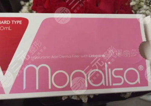莫納麗莎玻尿酸能維持多久