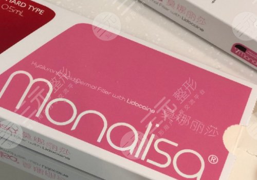 莫納麗莎玻尿酸能維持多久？