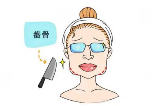 削骨三年后的真實案例