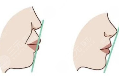 上海正頜醫(yī)生高偉怎么樣