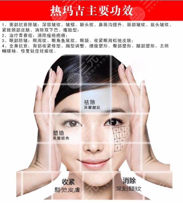 下頜線模糊適合超聲刀還是熱瑪吉?