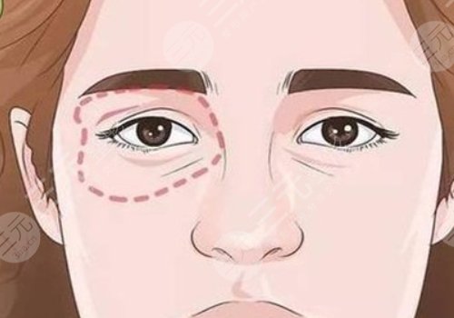 眼周老化問題怎么解決