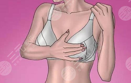 周珍艷醫(yī)生隆胸案例