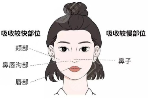 饅化臉做熱瑪吉好還是超聲炮好