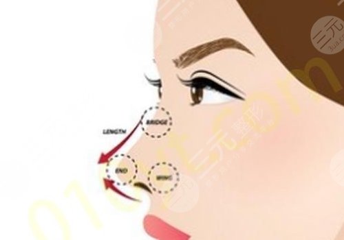 強(qiáng)生瑆珀假體缺點