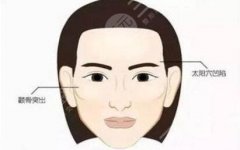 填充太陽凹陷脂肪能保持多久？科普小課堂！手術(shù)原理、價格查詢~