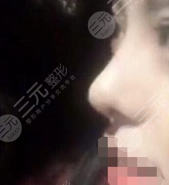 北京中關(guān)村醫(yī)院美容整形科技術(shù)優(yōu)勢(shì)有哪些?