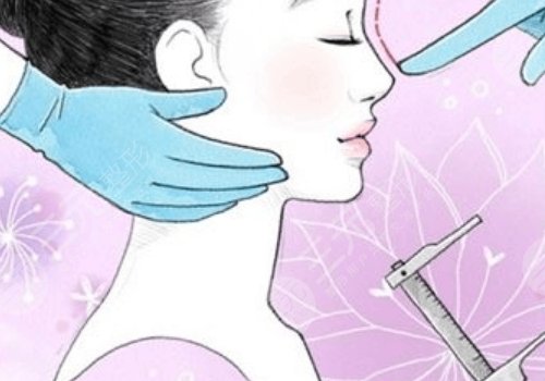 玻尿酸解決的面部問題有哪些