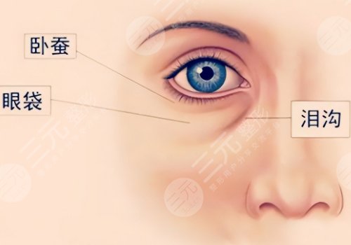 淚溝法令紋怎么改良