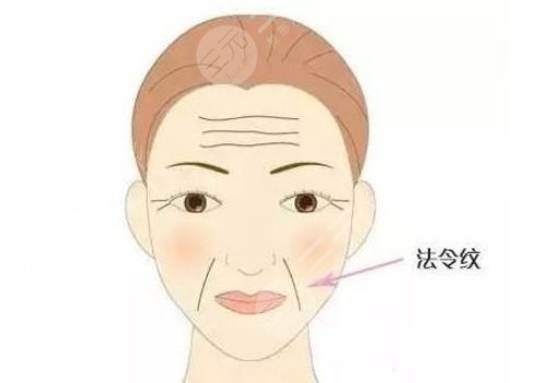 淚溝法令紋怎么改良