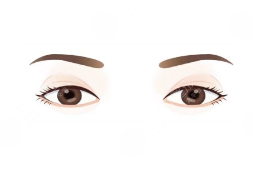 小切口雙眼皮能堅持幾年？