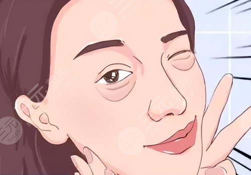 淚溝凹陷怎么解決好