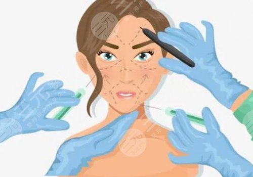 筋膜懸吊術(shù)可以維持幾年