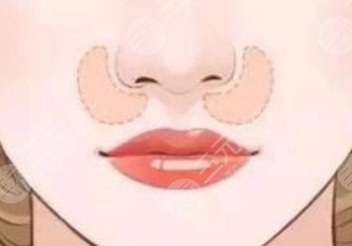 猴化臉鼻基底怎么解決