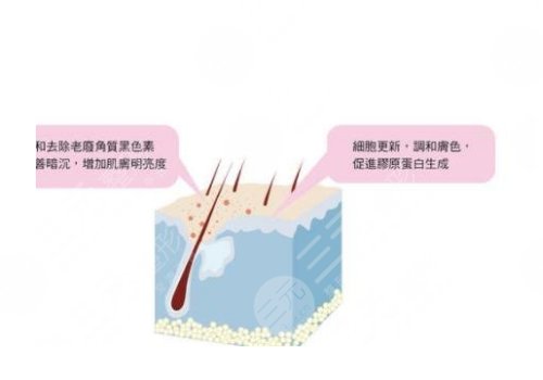 鐳射凈膚儀祛斑會(huì)反彈嗎