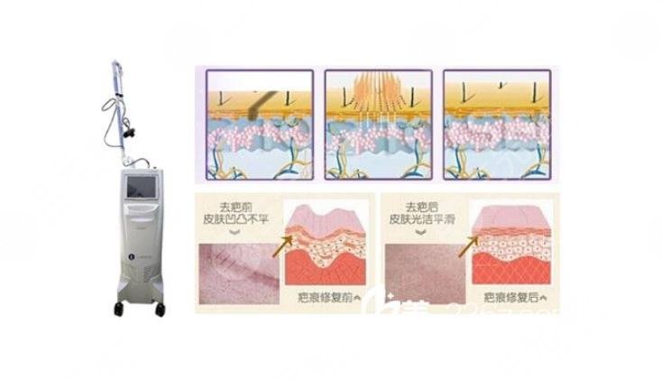 陳立彬?醫(yī)生做疤痕切除手術(shù)好嗎?