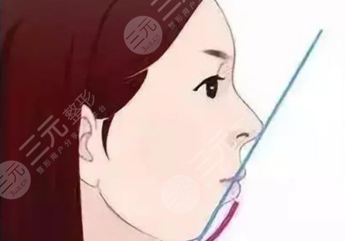 北口正頜李自力怎么樣