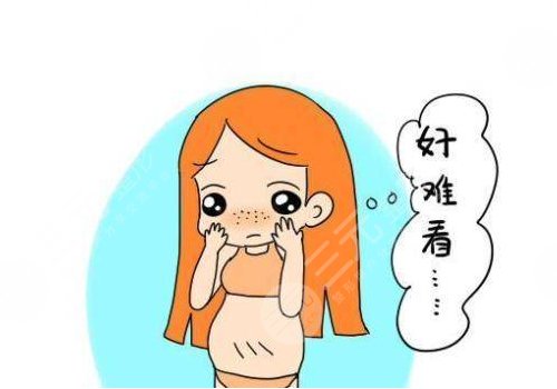 妊娠紋什么時(shí)候開始出現(xiàn)