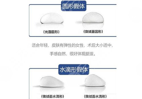 曼陀假體系列有幾款