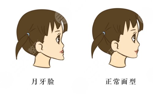 北口李自力正頜怎么樣