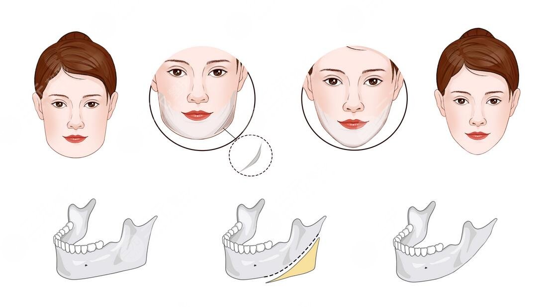 王旭東醫(yī)生怎么樣?