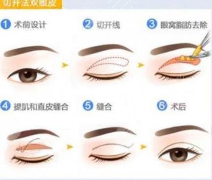 北京美萊醫(yī)療美容醫(yī)院擅長項(xiàng)目