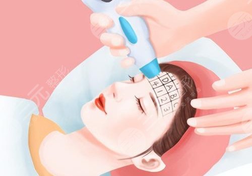 去色素斑用什么藥膏好？