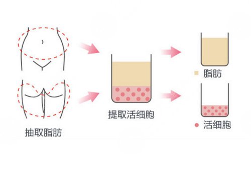 額頭填充有風(fēng)險嗎