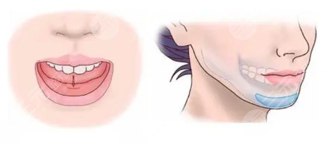 華西醫(yī)院整形科價(jià)目表新2023