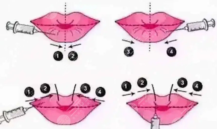 華西醫(yī)院整形科價(jià)目表新2023