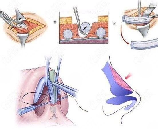 任天平醫(yī)生怎么樣啊?