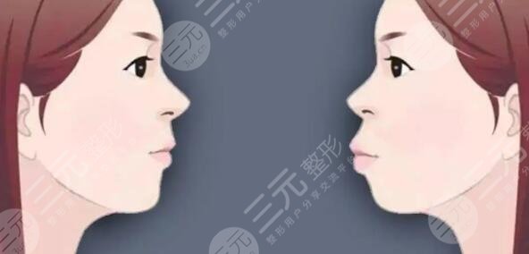 華西口腔醫(yī)院正頜手術(shù)擅長(zhǎng)醫(yī)生