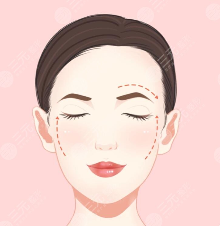 周敏茹醫(yī)生臉上微調(diào)怎么樣?