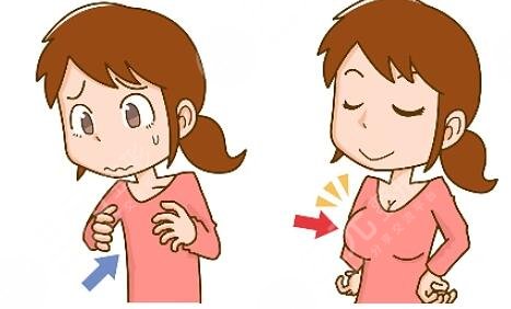 上海自體脂肪隆胸項目案例體驗反饋