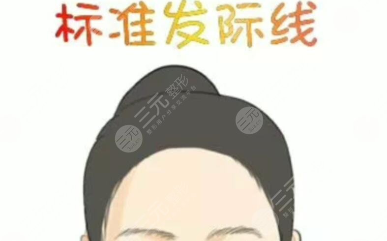 發(fā)際線種植