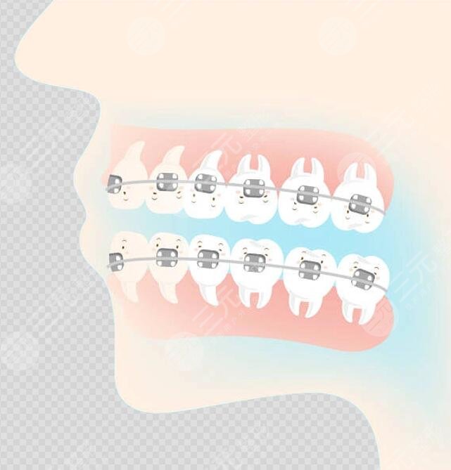 上海新華醫(yī)院口腔科牙齒矯正案例分享