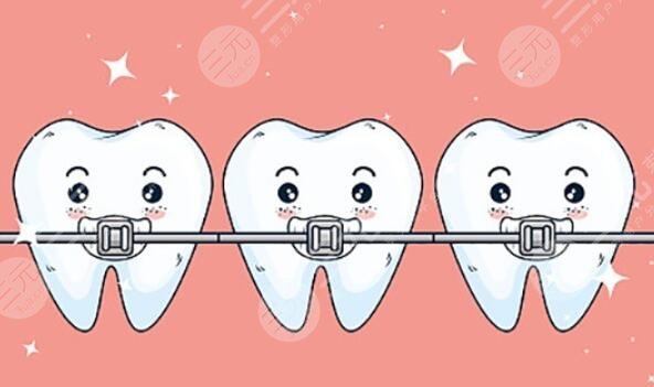 牙齒矯正