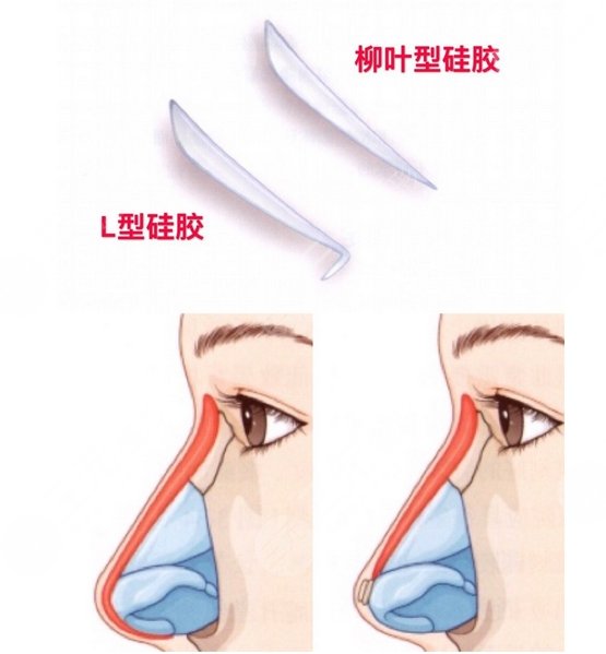 上海華美醫(yī)療美容醫(yī)院特色項目