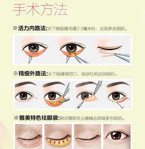 北京八大處整形美容外科醫(yī)院特色項(xiàng)目