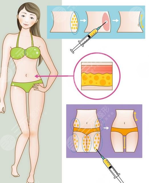 深圳陽光醫(yī)療美容醫(yī)院特色項(xiàng)目