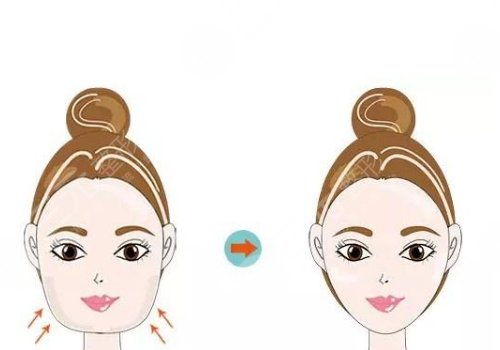 3d下頜角和長曲線下頜角區(qū)別是什么