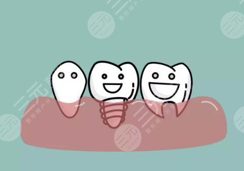 成都新橋口腔醫(yī)院種牙怎么樣