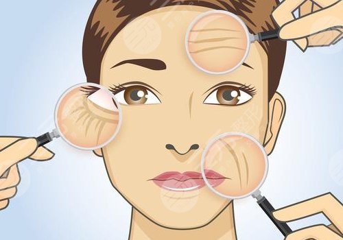 怎么可以消除皺紋