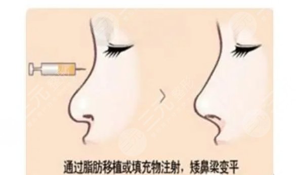 深圳陽光醫(yī)療美容醫(yī)院擅長項(xiàng)目