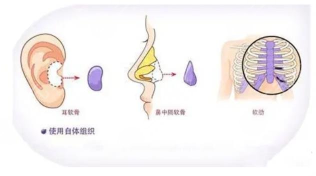 深圳陽光醫(yī)療美容醫(yī)院擅長科普知識