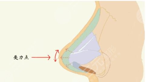 寧波藝星做鼻子醫(yī)生那個好？盧燕明假體隆鼻結(jié)果分享，寧波隆鼻醫(yī)生合集