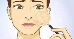 皮膚特別粗糙是什么原因？這6件事沒(méi)做好！4個(gè)醫(yī)美方法教你改良~