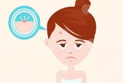 額頭上長(zhǎng)痘痘的原因是啥？這6點(diǎn)你平時(shí)肯定沒(méi)注意！