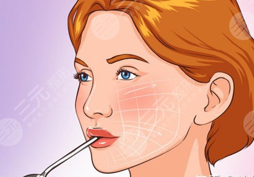 7d聚拉提大概全臉下來多少錢